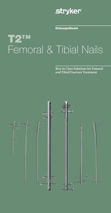 Recon nail orthobullets picture