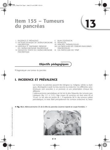 Tumeur Endocrine Du Grele