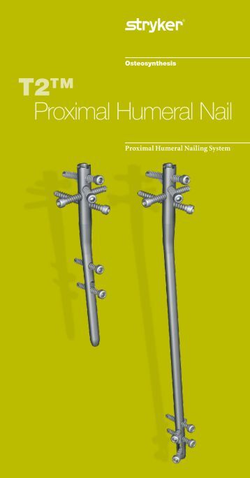 osteosynthesis stryker recon nail The t2 recon nail is the latest development for the treatment of proximal hip and diaphyseal femoral fractures. osteosynthesis stryker recon nail The t2 recon nail is the latest development for the treatment of proximal hip and diaphyseal femoral fractures.