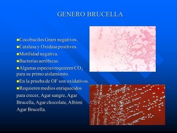 GENERO BRUCELLA - MICROBITOS