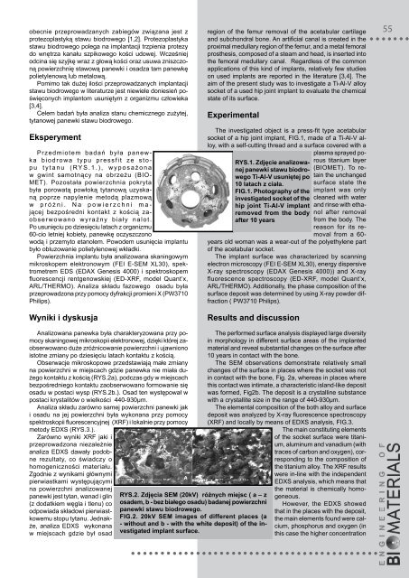 89-91 - Polskie Stowarzyszenie Biomateriałów