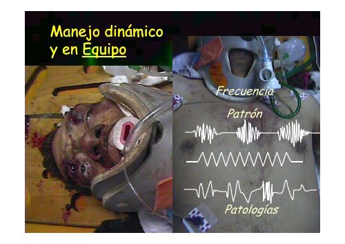 Cba_trauma%20y%20Triagge%20(red)x(1)