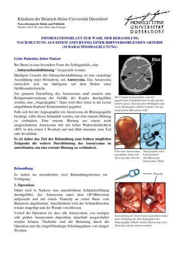 klicken! (PDF) - Neurochirurgische Klinik - Heinrich-Heine ...