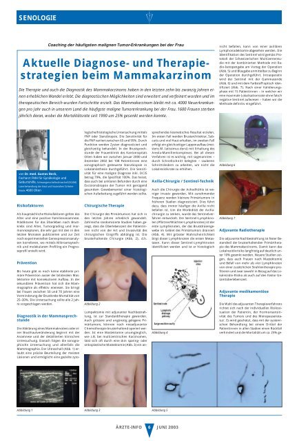 Diagnose- und Therapiestrategien beim Mammakarzinom