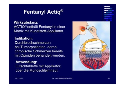 Schmerz beim älteren Patienten