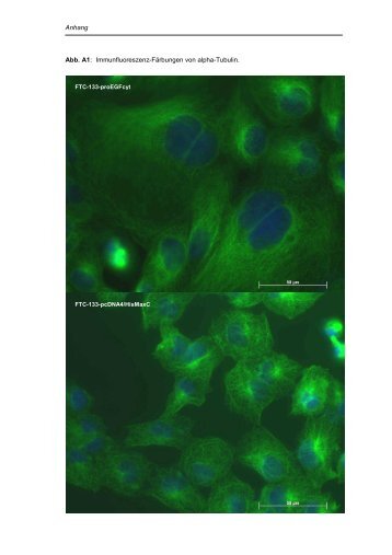 Anhang Abb. A1: Immunfluoreszenz-Färbungen von alpha-Tubulin.