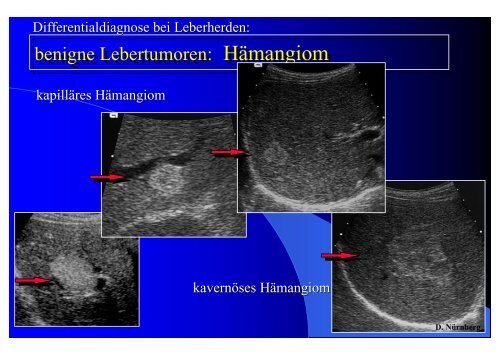 Sonographie bei Lebererkrankungen