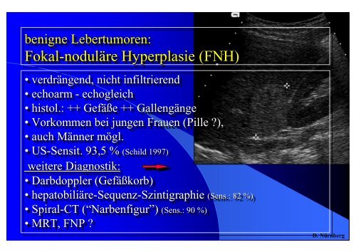 Sonographie bei Lebererkrankungen