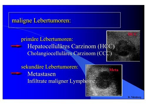 Sonographie bei Lebererkrankungen