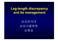 Leg-length discrepancy and Its management