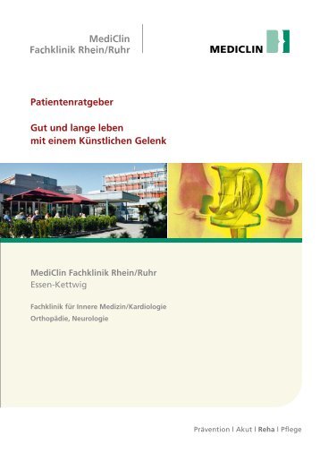 Patientenratgeber Gut und lange leben mit einem Künstlichen Gelenk