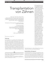 Transplantation von Zähnen - SSO