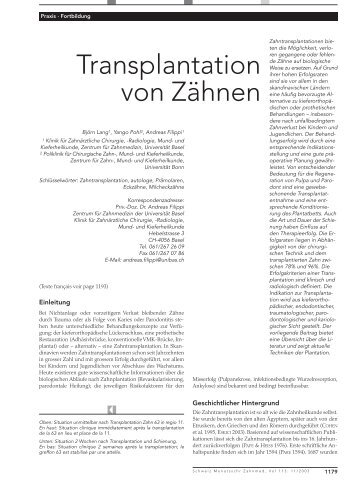 Transplantation von Zähnen - SSO