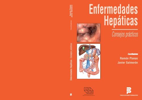 diabetes de conexión cerrada de protocolo retorcido