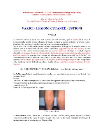 VARICI - LESIONI CUTANEE - USTIONI - Terapia compressiva