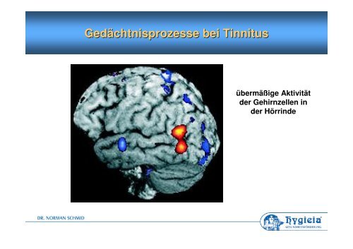 Psychologische Behandlung Bei Tinnitus, Hörsturz Und Hyperakusis