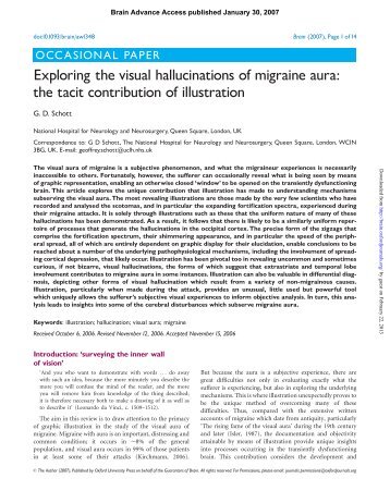 Exploring the visual hallucinations of migraine aura: the tacit ... - Brain