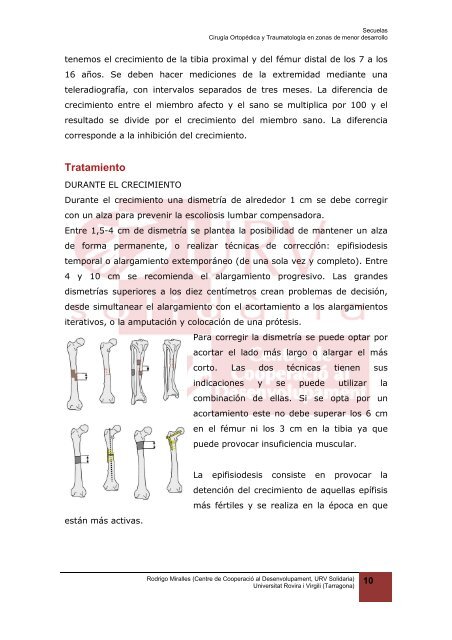 Dismetría - Universitat Rovira i Virgili