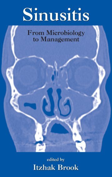 Sinusitis : From Microbiology To Management - Edocr