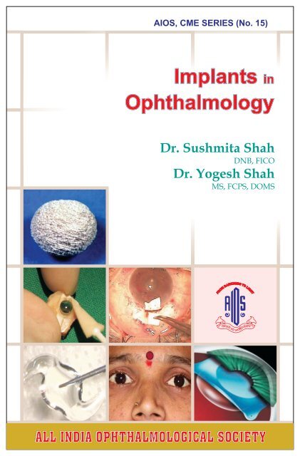 Implants in Ophthalmology - All India Ophthalmological Society