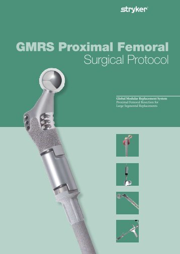 GMRS Proximal Femoral Surgical Protocol