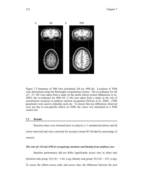 Mirror-touch synaesthesia: the role of shared ... - UCL Discovery