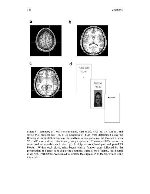 Mirror-touch synaesthesia: the role of shared ... - UCL Discovery