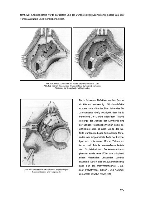 Dissertation Haußler - Universität zu Lübeck