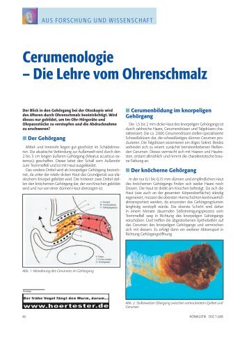 Cerumenologie: Die Lehre vom Ohrenschmalz (Hoffmann)