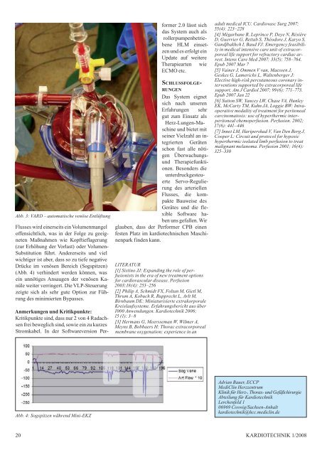 Performer Cardio Pulmonary Bypass