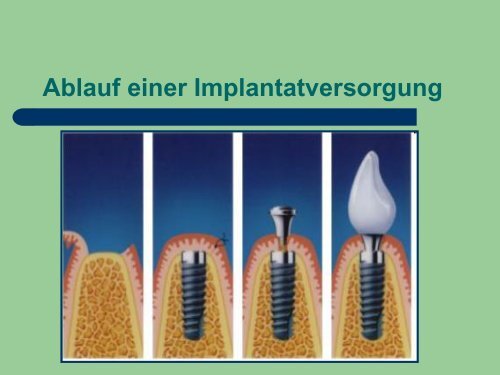 Implantat Prophylaxe