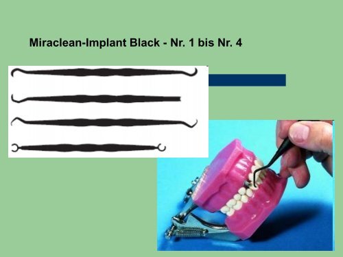 Implantat Prophylaxe