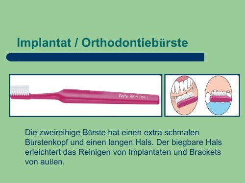 Implantat Prophylaxe