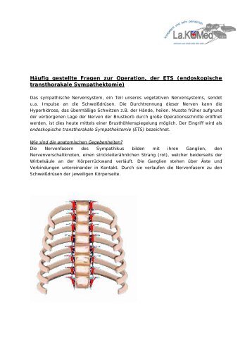 endoskopische transthorakale Sympathektomie