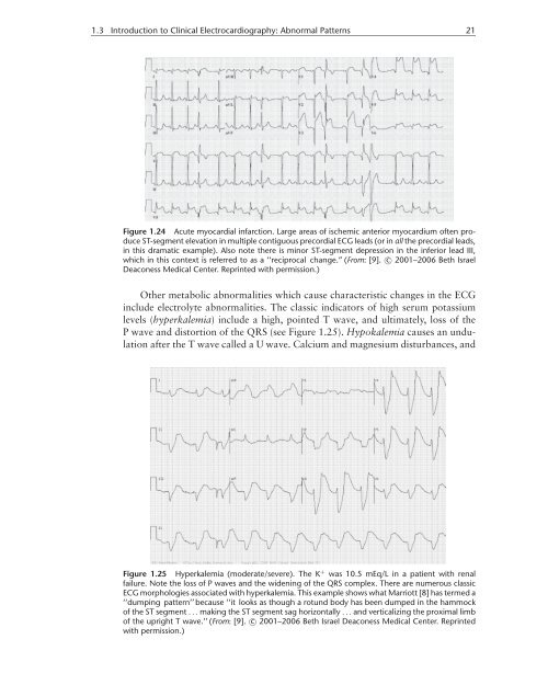 Physiological Basis of the Electrocardiogram