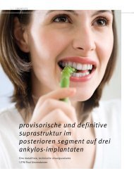 provisorische und definitive suprastruktur im posterioren segment ...