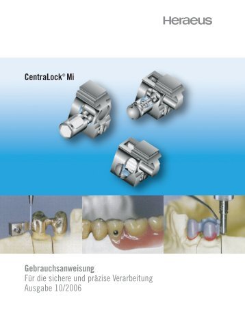 CentraLock Mi - Hera - Heraeus Dental