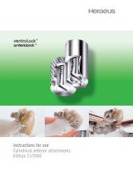 Instructions for use Cylindrical anterior ... - Heraeus Kulzer