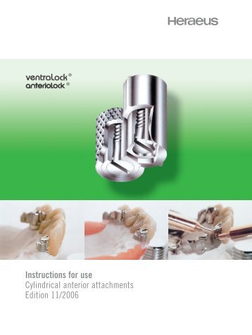 Instructions for use Cylindrical anterior ... - Heraeus Kulzer