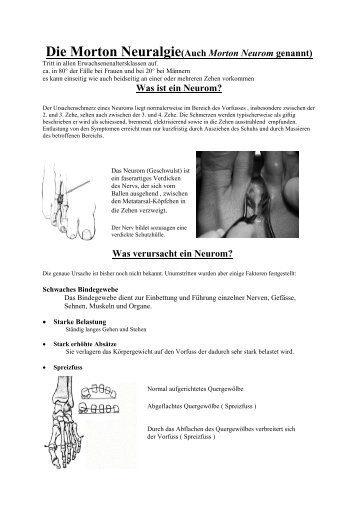 Die Morton Neuralgie(Auch Morton Neurom genannt) - Glauser AG