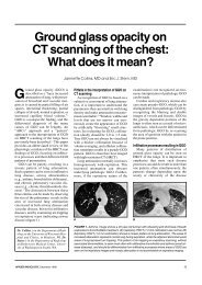 Ground glass opacity on CT scanning of the chest: What does it mean?