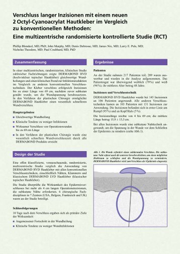 Dermabond Studie - Ethicon