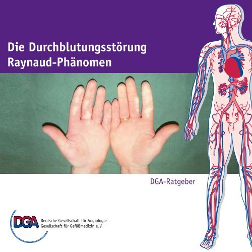 Die Durchblutungsstörung Raynaud-Phänomen - der Deutschen ...