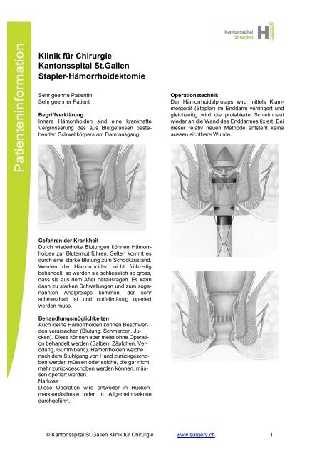 Hämorrhoiden - Beckenbodenzentrum - Kantonsspital St. Gallen