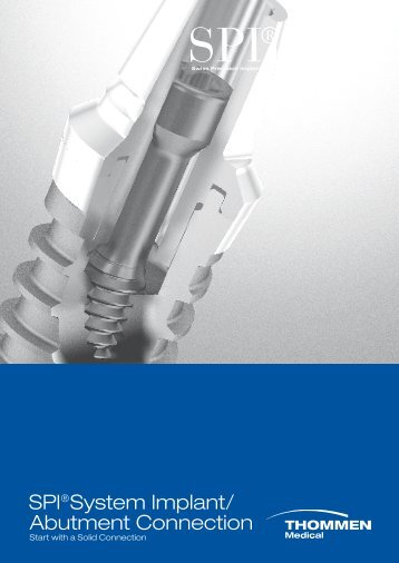 SPI®System Implant/ Abutment Connection - Poisson Bouge