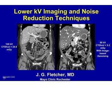 Lower kV Imaging and Noise Reduction Techniques - Research ...