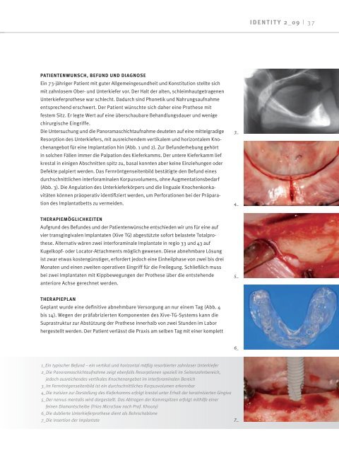 best_age best_age - DENTSPLY Friadent