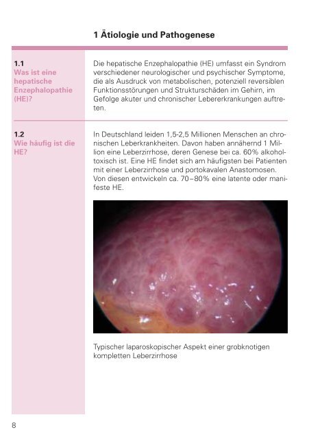 Hepatische Enzephalopathie - Dr. Falk Pharma GmbH