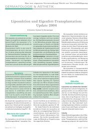 Liposuktion und Eigenfett-Transplantation: Update 2004