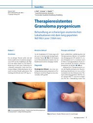 Therapieresistentes Granuloma pyogenicum - Laserklinik Karlsruhe